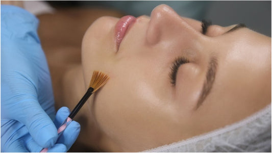 The Magic of Chemical Peels: Revealing a Fresher You